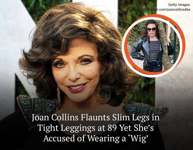 Joan Collins Blasted for Using ‘Fillers’ & ‘Wig’ — She Looks Stunning & Feels Happy with 32-Years-Younger Husband