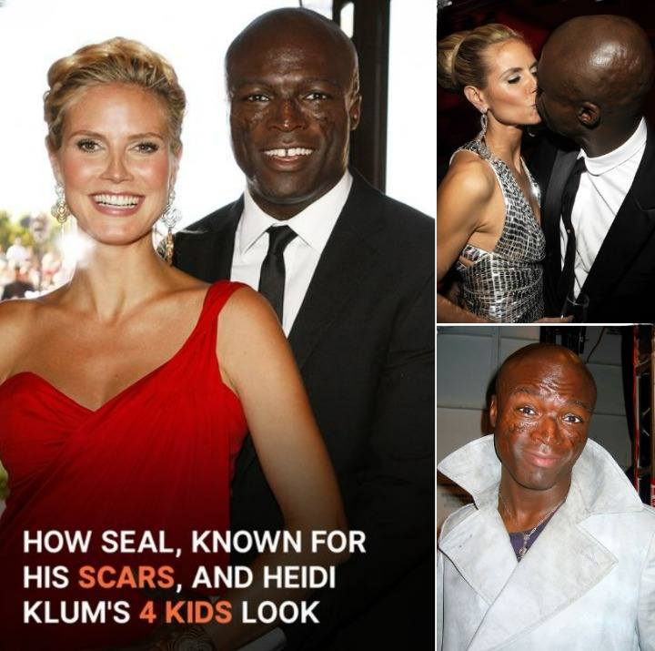 How Heidi Klum and Seal’s 4 Kids Look: Family Photos Including Seal’s Distinctive Scars