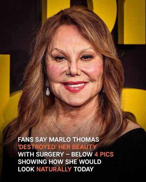 Fans Say Marlo Thomas ‘Destroyed’ Her Beauty with Surgery: How She Would Look Today Naturally